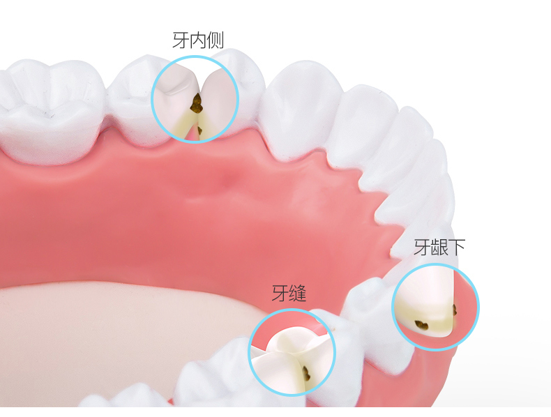 洗牙器作用